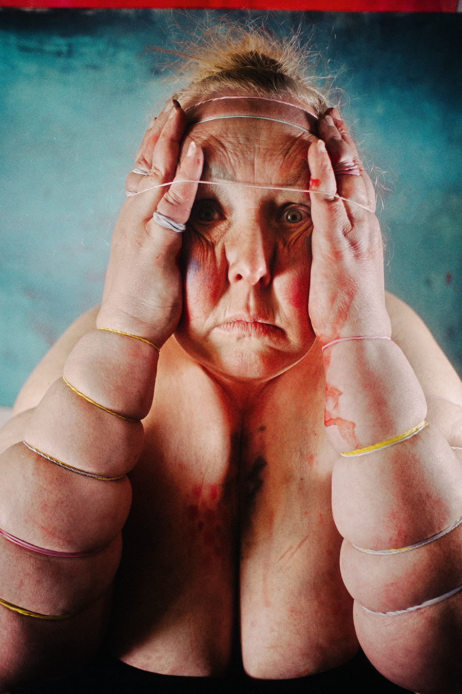 Hände pressen Wangen zusammen, Gummibänder quer über Kopf und Finger gespannt, intensiver direkter Blick in die Kamera – körperliche Selbstporträt-Fotografie Antje Kröger Leipzig Berlin, Serie Mehrenge