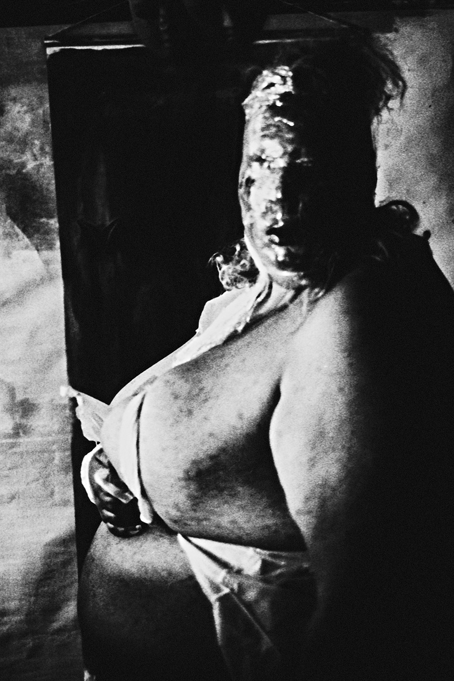 analoge fotokunst leipzig, Analogfoto auf Fomapan 400 Ortho, um eine Stufe gepusht, stark körnig. Eine dicke Frau steht frontal, der breite Oberkörper teilweise freigelegt. Ihr Gesicht ist vollständig mit einer glänzenden hellen Substanz bedeckt und dadurch unkenntlich. Im Hintergrund ein dunkles Metallgestell ohne sichtbare Maske.