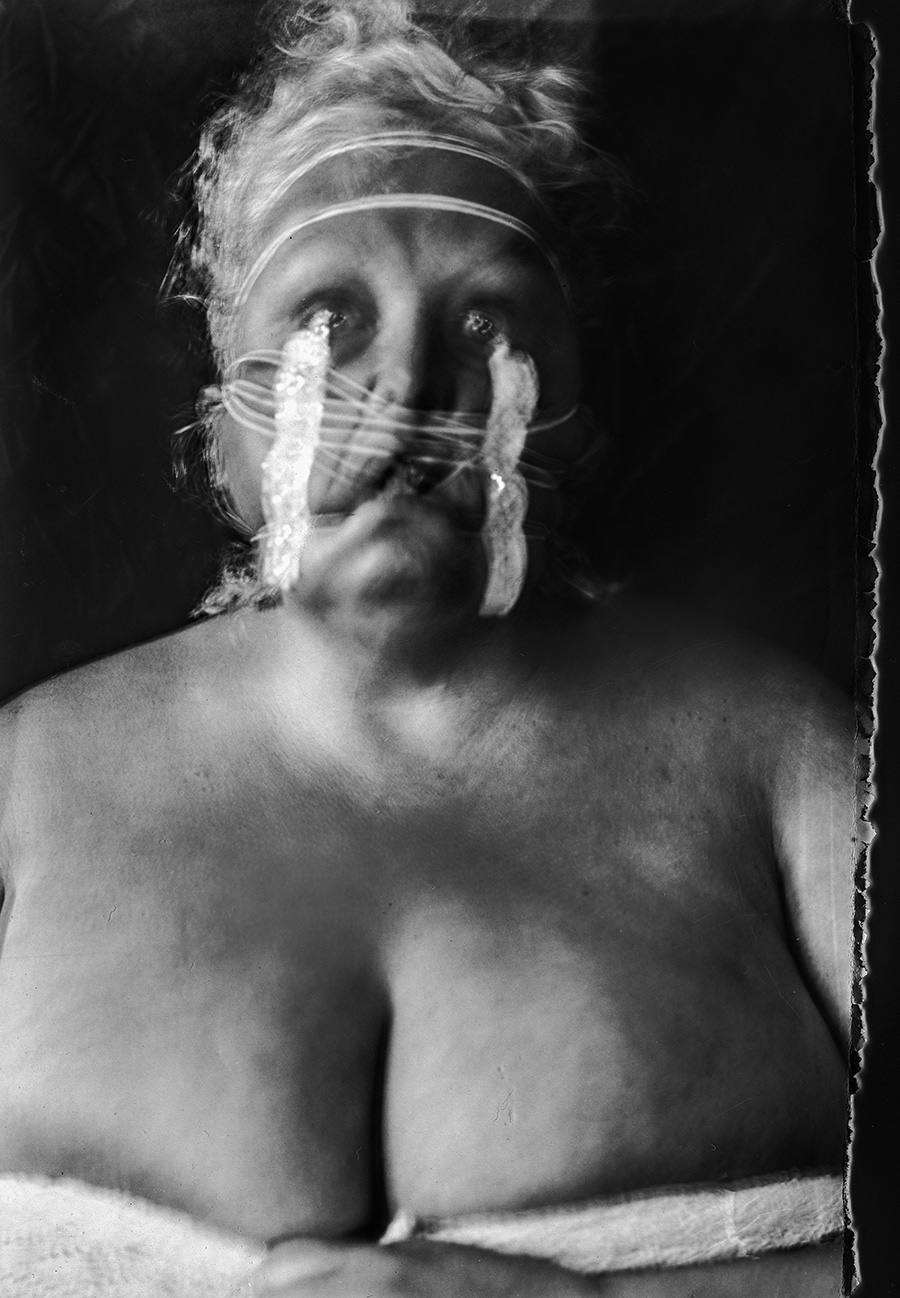 Analoges Selbstporträt auf Fotopapier, Gummibänder mit Spitzenbesatz über Gesicht, nackter Oberkörper, Überbelichtung oben, Kamera Mentor, Serie Scheinbarkeit, Antje Kröger